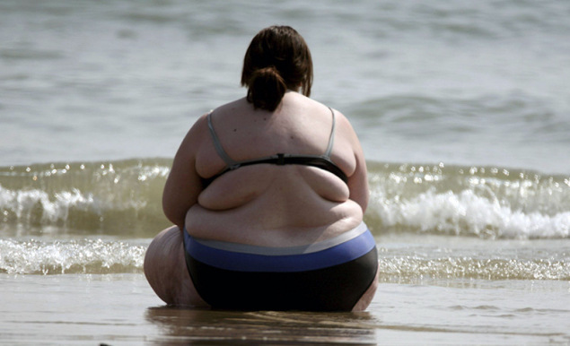 Debelost je (tudi) zelo draga