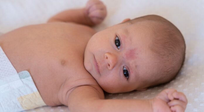 Nosečnice lahko z jemanjem probiotikov preprečijo ekceme pri otrocih