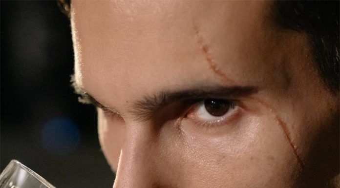 Študija: Ženskam so bolj privlačni moški z brazgotinami