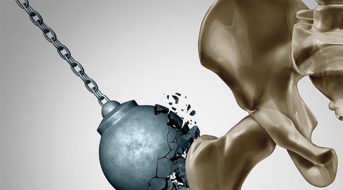 Omega-3 pripomorejo k manjši izgubi kostne mase