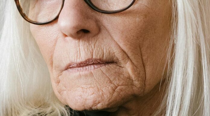 Imate veliko gub? To lahko pomeni slabe kosti