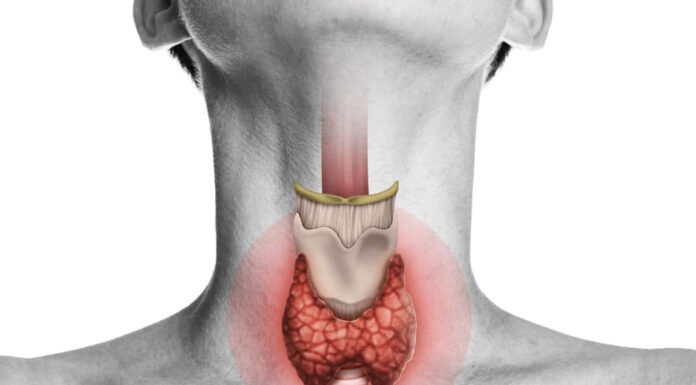 V razvitih državah čedalje večje pomanjkanje joda