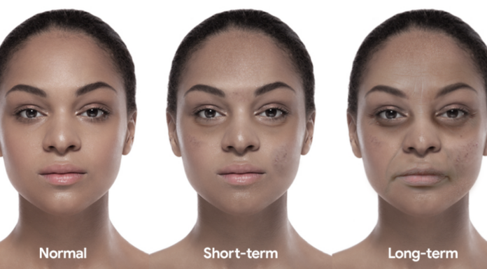 Pomanjkanje spanja pospešuje staranje