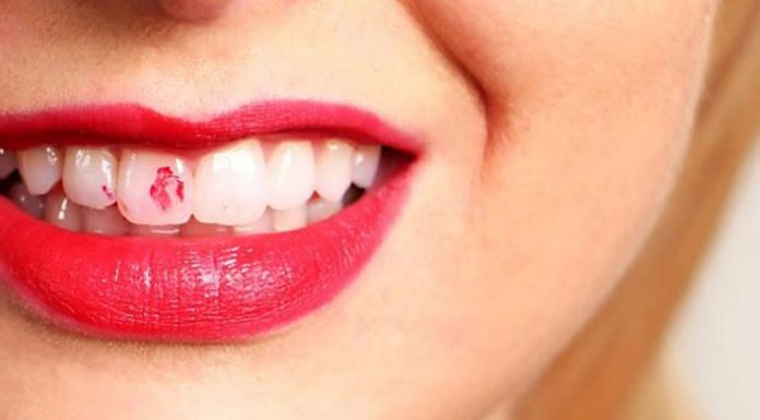 7 lepotnih problemov, ki nas spravljajo v obup