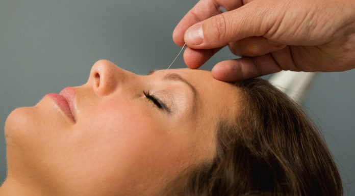 6 načinov kako akupunktura spremeni možgane
