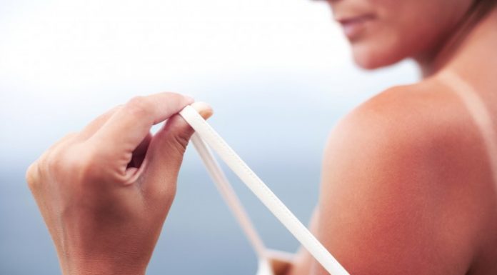 10 čustvenih faz, skozi katere greste, ko vas opeče sonce