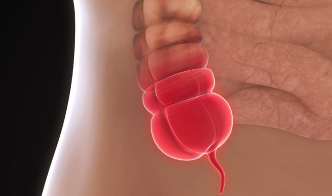 Slepič ni nepotreben organ: medicina je bila v veliki zmoti