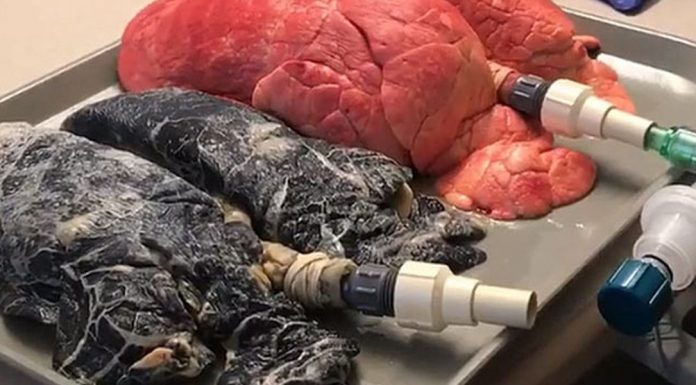 VIDEO: razlika med pljuči kadilca in nekadilca