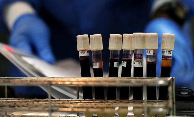 Kaj vaša krvna skupina razkrije o vašem zdravju (veliko več, kot si mislite)