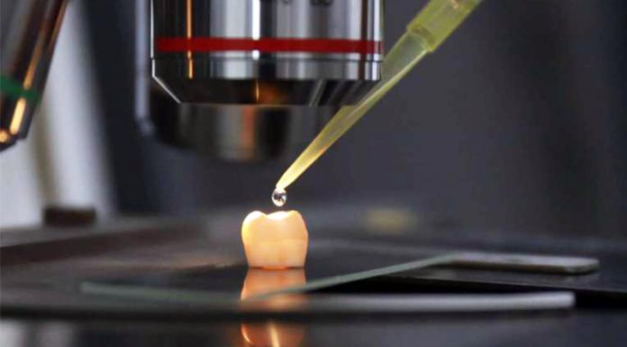 Znanstveniki razvili gel, ki spodbudi rast nove sklenine