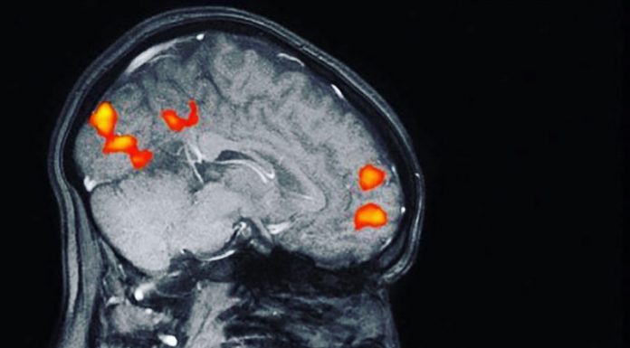 Posnetek magnetne resonance pokazal, kako se ustvarja vez med materjo in otrokom