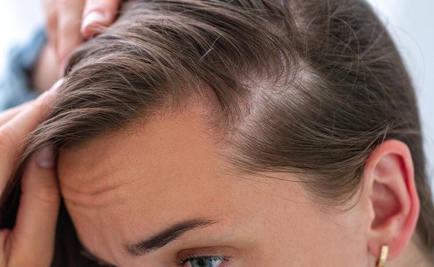 5 mitov o izgubi las, ki jim ljudje pogosto verjamejo