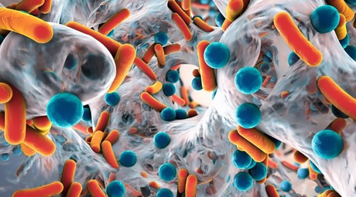 S prehrano sami vplivate na svojo črevesno mikrofloro