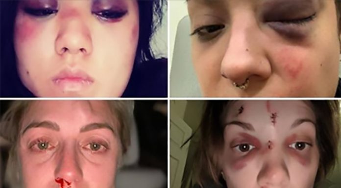 Karantena in izolacija: tako brutalno so bile pretepene (in nekatere tudi umorjene)