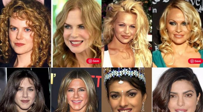 10 zvezdnic pred in po lepotnih operacijah