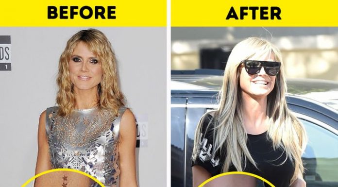 Zvezdniki, ki so se odločili za odstranitev tetovaž