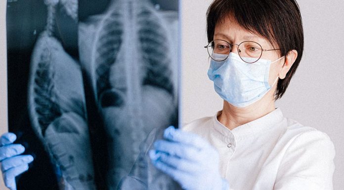 Zdravniki svarijo: zaradi nošenja mask se lahko bojimo epidemije bakterijskih pljučnic