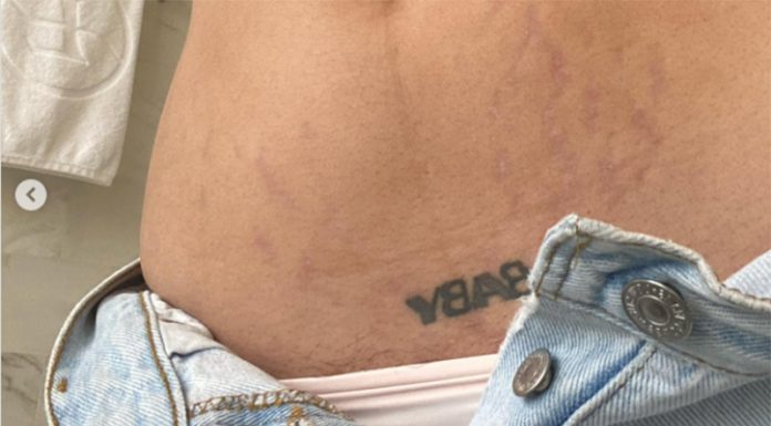 Pevka iskreno spregovorila o posledicah, ki jih je na njenem telesu pustila nosečnost