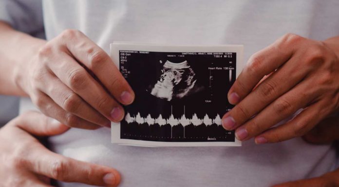 3 pogosti miti o carskem rezu