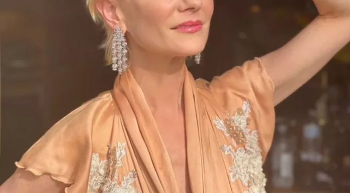 Zvezdnica utrpela hudo poškodbo možganov in dvomijo, da bo preživela