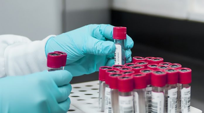 Znanstveniki so odkrili nov sklop krvnih skupin