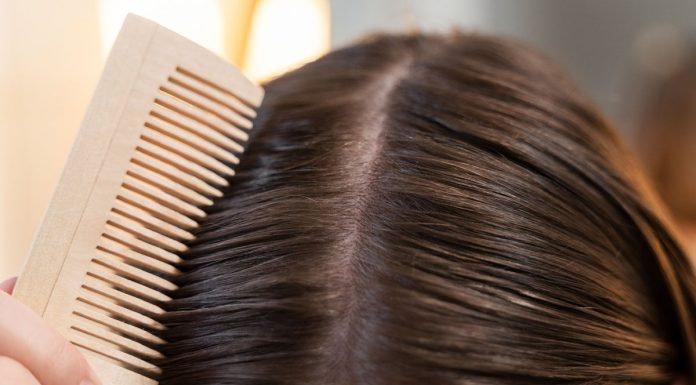 Kako se spopasti z redčenjem in izpadanjem las? redčenje-las