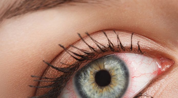 6 nenavadnih načinov, kako vas telo opozori, da je nekaj narobe