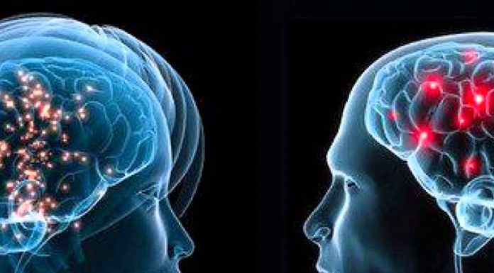 Študija: Ženske imajo aktivnejše možgane kot moški