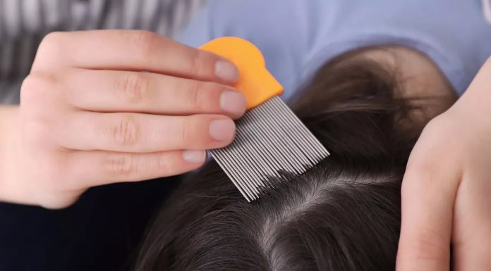 Mama hčerki noče odpraviti naglavnih uši, ker je veganka