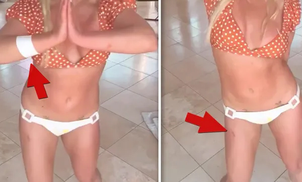 Po plesu z noži se je pevka pokazala porezana in povita; oboževalci zaskrbljeni