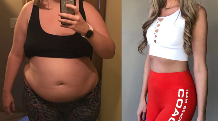 Zvezdniki, ki so priznali, da so shujšali s pomočjo zdravila Ozempic