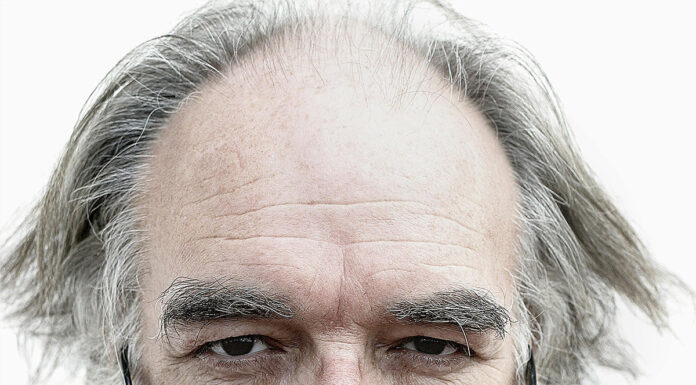 Test osebnosti: gube na čelu razkrivajo vašo osebnost