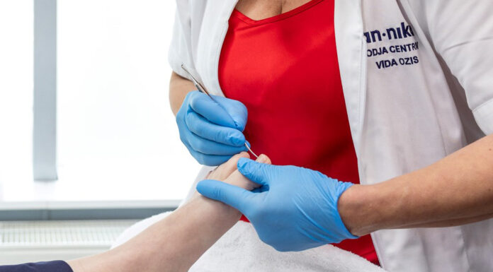 Vraščen noht si lahko s pravilno nego rešite za vse življenje