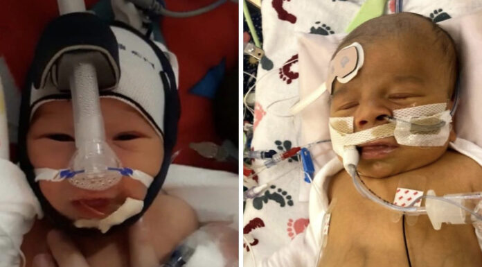 Dojenček umrl zaradi krvnega strdka po transfuziji krvi, dobljene od cepljenih za Covid