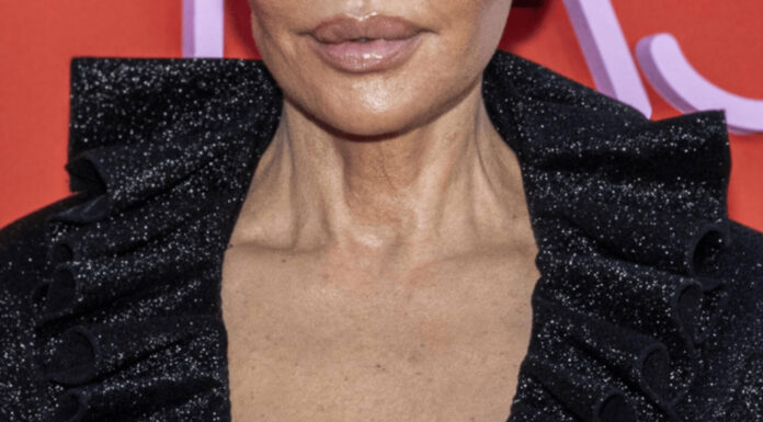 Po reakcijah šokiranih oboževalcev si je igralka dala raztopiti obrazna polnila