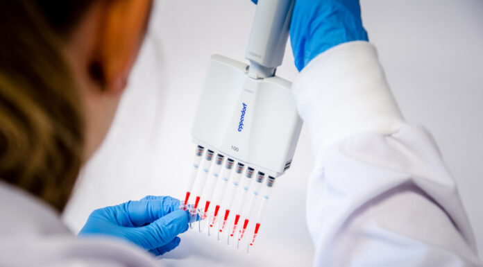 Luč na koncu tunela: V Labeni brezplačno sorazvijajo zdravilo za Urbana