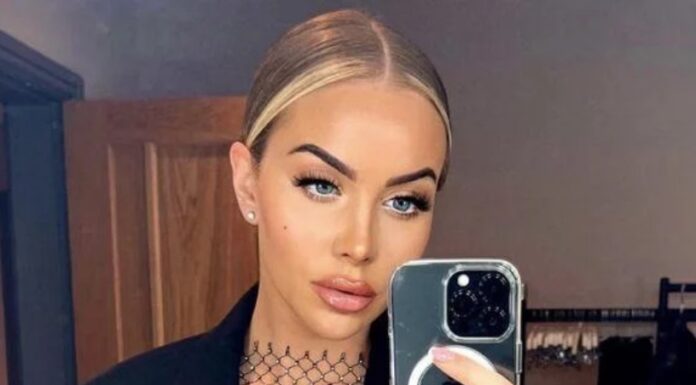 Zaradi dolgoletne zlorabe polnil je morala pri 34-ih na lifting obraza