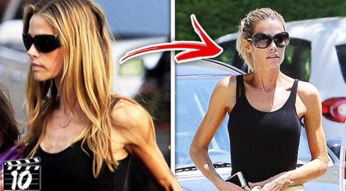 Zdravniki svarijo: Hollywood pretirava z Ozempicom!