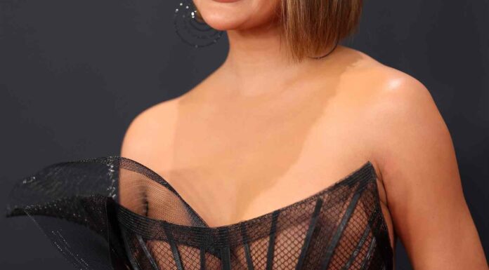 Zvezdnica si je s plastično operacijo znižala čelo oz. lasišče