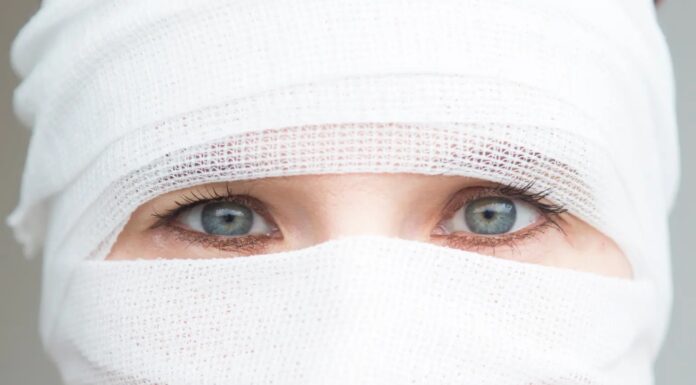 V tako skrajnost gredo nekateri zvezdniki, da se ne bi razvedelo o njihovih lepotnih posegih