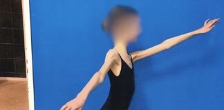 Starša stradala svojo 17-letno hčerko, da je tehtala le 28 kg