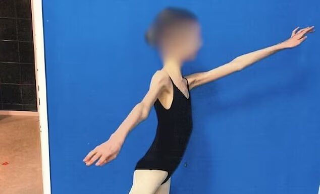 Starša stradala svojo 17-letno hčerko, da je tehtala le 28 kg