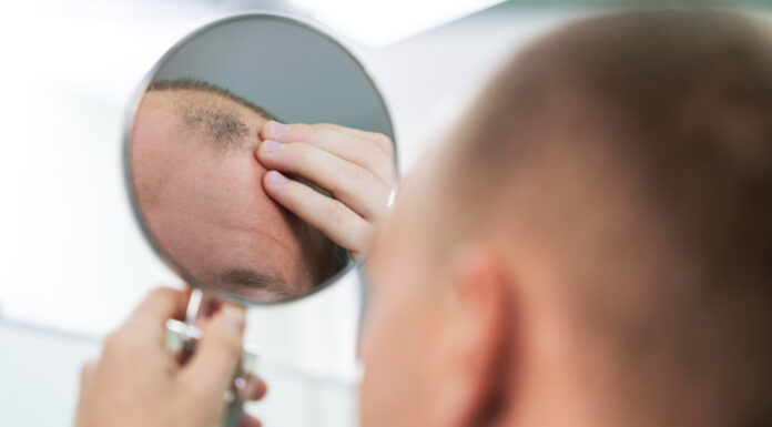 Prihaja serum, ki bo rešil plešavost v 20 dneh?